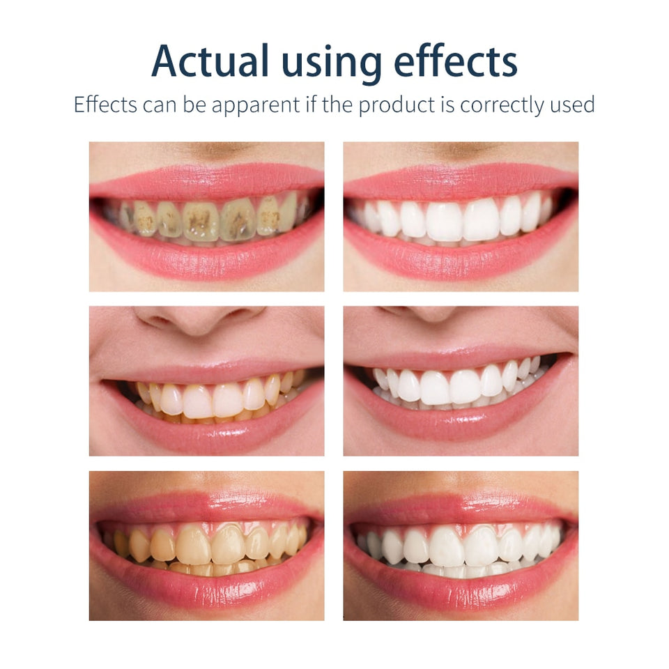 Tooth-Cleaning Mousse Toothpaste