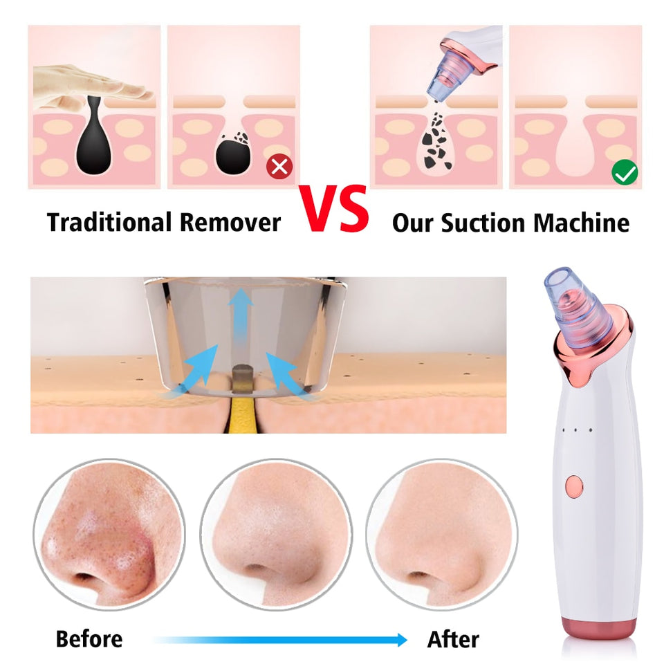 Electric Blackhead Vacuum Cleaner