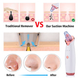 Electric Blackhead Vacuum Cleaner