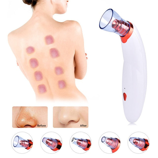 Electric Blackhead Vacuum Cleaner