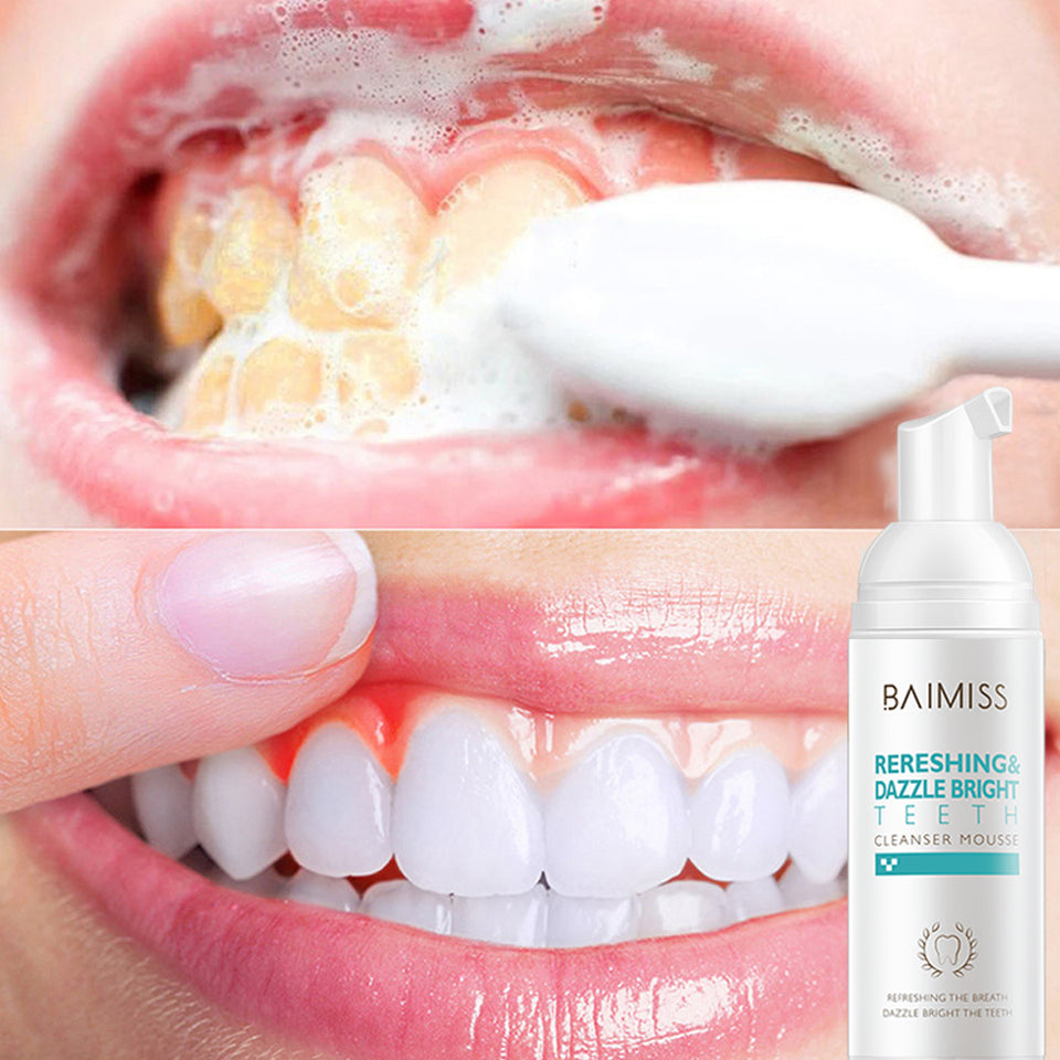 Tooth-Cleaning Mousse Toothpaste