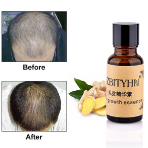 Hair Growth Essence Anti Hair Loss Serum