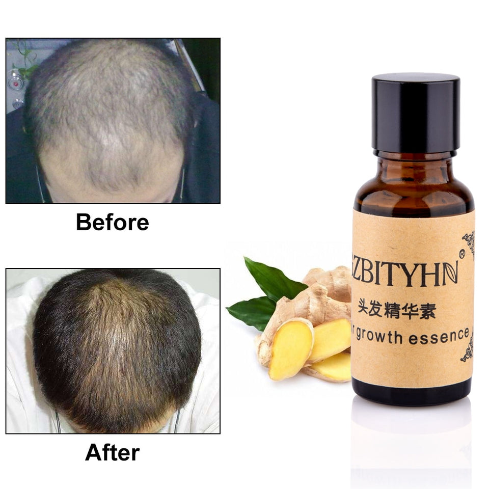 Hair Growth Essence Anti Hair Loss Serum